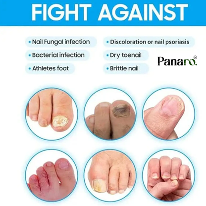 Nail growth oil/nail growth serum Nail Treatment Repair Gel