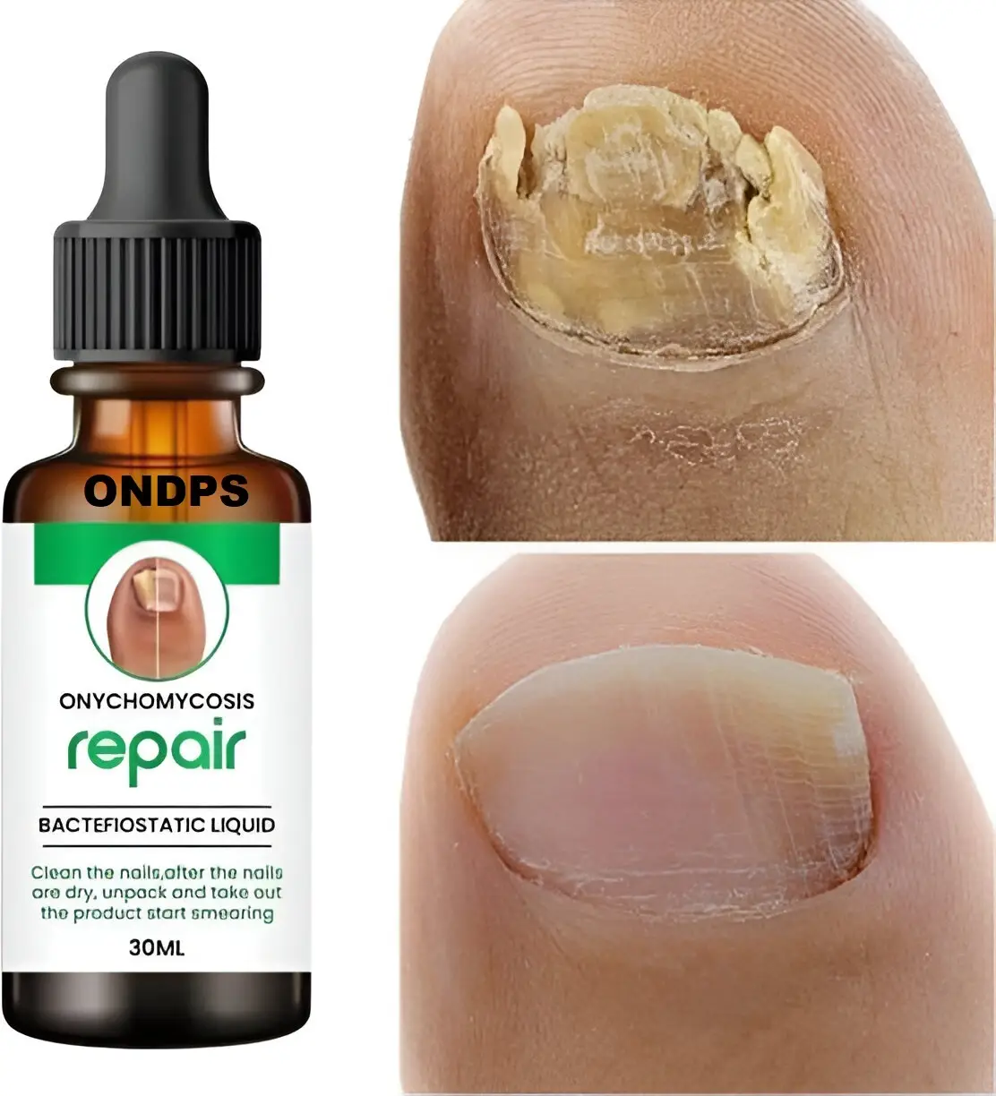 Nail growth oil/nail growth serum Nail Treatment Repair Gel